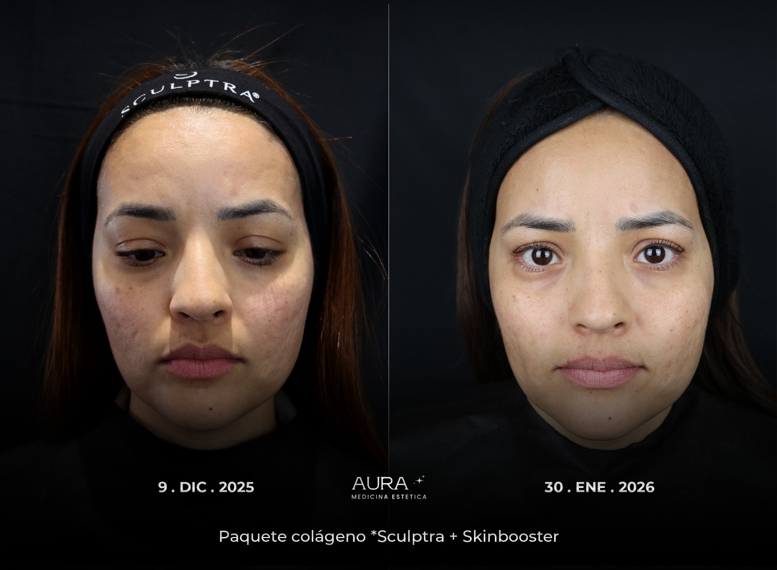 Antes y después de tratamiento corporal o facial